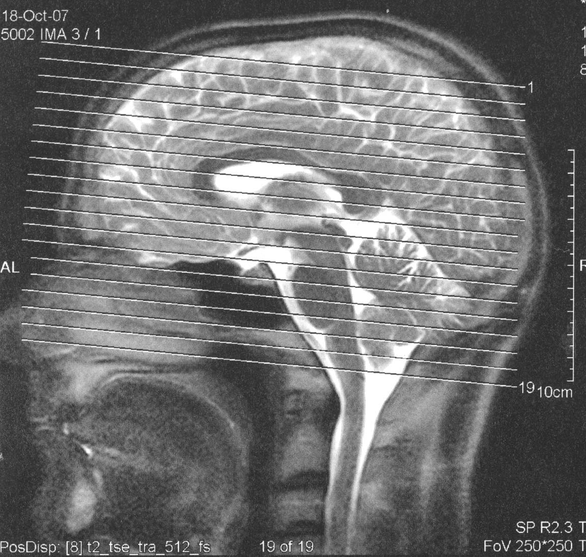 Schädel mit Querschnitten.jpg